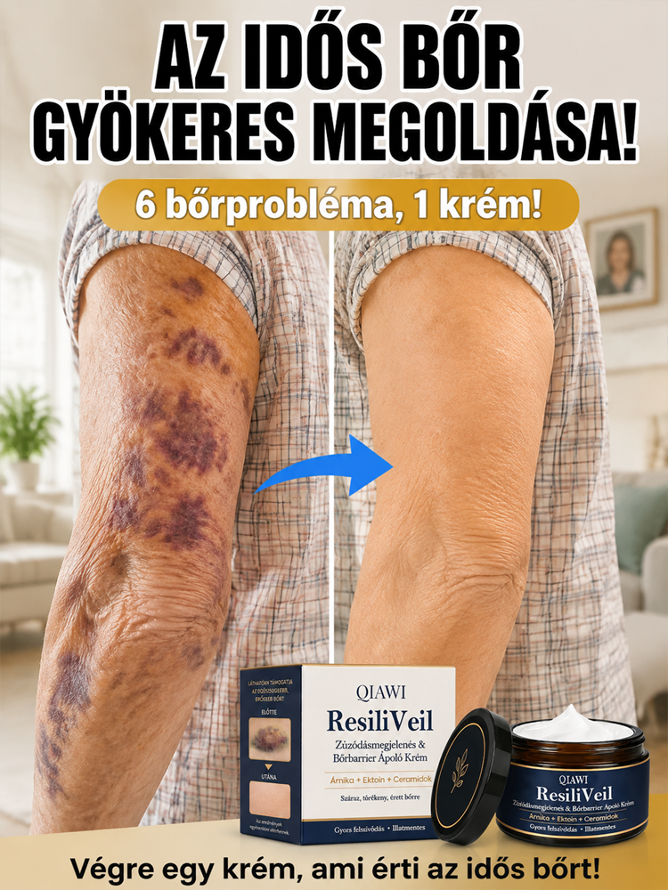 【1denní odstranění zelenofialových stařeckých skvrn】Regenerační krém na podkožní modřiny