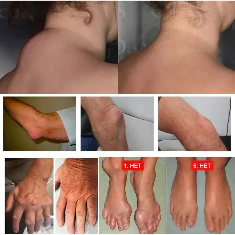 Hadí kost pět jedů zlatý kostní olej