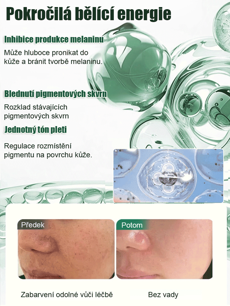 【Jedním stříknutím odstraní】Bělicí a odstraňující skvrny sprej