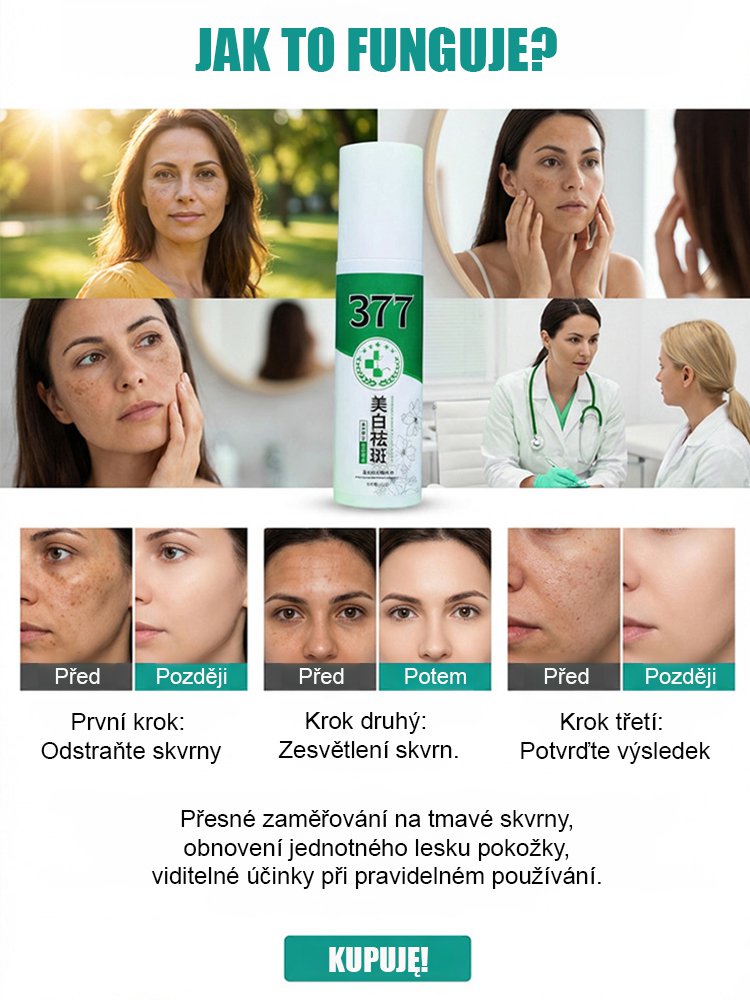 【Jedním stříknutím odstraní】Bělicí a odstraňující skvrny sprej