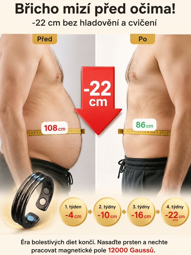 Německý lékařský magnetický prsten pro kontrolu cukru, zabraňuje komplikacím